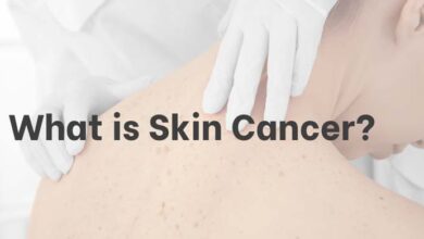 Photo of Skin Cancer And Everything You Need To Know